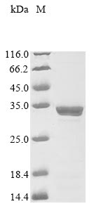 Recombinant Human metapneumovirus Matrix protein (M) - image 1
