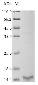 (Tris-Glycine gel) Discontinuous SDS-PAGE (reduced) with 5% enrichment gel and 15% separation gel. (Tris-Glycine gel) Discontinuous SDS-PAGE (reduced) with 5% enrichment gel and 15% separation gel.