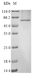 (Tris-Glycine gel) Discontinuous SDS-PAGE (reduced) with 5% enrichment gel and 15% separation gel. (Tris-Glycine gel) Discontinuous SDS-PAGE (reduced) with 5% enrichment gel and 15% separation gel.