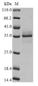 (Tris-Glycine gel) Discontinuous SDS-PAGE (reduced) with 5% enrichment gel and 15% separation gel. (Tris-Glycine gel) Discontinuous SDS-PAGE (reduced) with 5% enrichment gel and 15% separation gel.