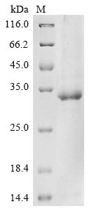 (Tris-Glycine gel) Discontinuous SDS-PAGE (reduced) with 5% enrichment gel and 15% separation gel. (Tris-Glycine gel) Discontinuous SDS-PAGE (reduced) with 5% enrichment gel and 15% separation gel.