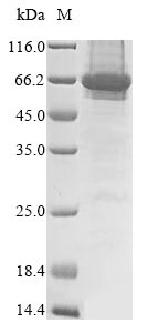 (Tris-Glycine gel) Discontinuous SDS-PAGE (reduced) with 5% enrichment gel and 15% separation gel. (Tris-Glycine gel) Discontinuous SDS-PAGE (reduced) with 5% enrichment gel and 15% separation gel.