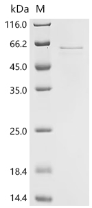 Recombinant Human Coiled-coil domain-containing protein 112 (CCDC112 ) - image 1