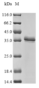 (Tris-Glycine gel) Discontinuous SDS-PAGE (reduced) with 5% enrichment gel and 15% separation gel. (Tris-Glycine gel) Discontinuous SDS-PAGE (reduced) with 5% enrichment gel and 15% separation gel.
