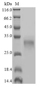 (Tris-Glycine gel) Discontinuous SDS-PAGE (reduced) with 5% enrichment gel and 15% separation gel. (Tris-Glycine gel) Discontinuous SDS-PAGE (reduced) with 5% enrichment gel and 15% separation gel.