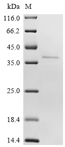 Recombinant Human Kinesin-like protein KIFC2 (KIFC2) , partial - image 1