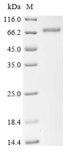 Recombinant Human OTU domain-containing protein 5 (OTUD5) - image 1