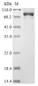 (Tris-Glycine gel) Discontinuous SDS-PAGE (reduced) with 5% enrichment gel and 15% separation gel. (Tris-Glycine gel) Discontinuous SDS-PAGE (reduced) with 5% enrichment gel and 15% separation gel.