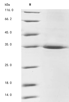 (Tris-Glycine gel) Discontinuous SDS-PAGE (reduced) with 5% enrichment gel and 15% separation gel. (Tris-Glycine gel) Discontinuous SDS-PAGE (reduced) with 5% enrichment gel and 15% separation gel.