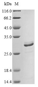 (Tris-Glycine gel) Discontinuous SDS-PAGE (reduced) with 5% enrichment gel and 15% separation gel. (Tris-Glycine gel) Discontinuous SDS-PAGE (reduced) with 5% enrichment gel and 15% separation gel.