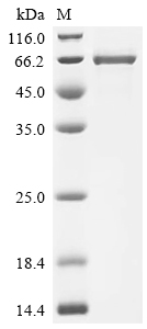 Recombinant Human Desmoglein-1 (DSG1) , partial - image 1