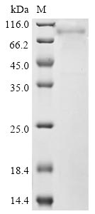 (Tris-Glycine gel) Discontinuous SDS-PAGE (reduced) with 5% enrichment gel and 15% separation gel. (Tris-Glycine gel) Discontinuous SDS-PAGE (reduced) with 5% enrichment gel and 15% separation gel.