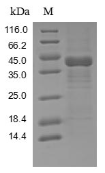 (Tris-Glycine gel) Discontinuous SDS-PAGE (reduced) with 5% enrichment gel and 15% separation gel. (Tris-Glycine gel) Discontinuous SDS-PAGE (reduced) with 5% enrichment gel and 15% separation gel.