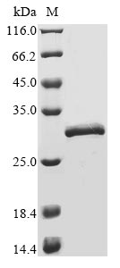 (Tris-Glycine gel) Discontinuous SDS-PAGE (reduced) with 5% enrichment gel and 15% separation gel. (Tris-Glycine gel) Discontinuous SDS-PAGE (reduced) with 5% enrichment gel and 15% separation gel.