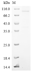 Recombinant Human Band 4.1-like protein 5 (EPB41L5) - image 1