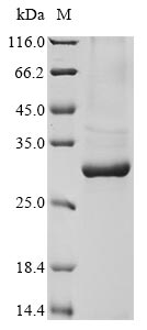 (Tris-Glycine gel) Discontinuous SDS-PAGE (reduced) with 5% enrichment gel and 15% separation gel. (Tris-Glycine gel) Discontinuous SDS-PAGE (reduced) with 5% enrichment gel and 15% separation gel.