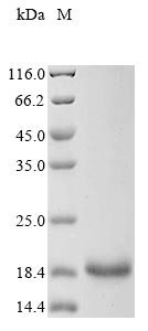 (Tris-Glycine gel) Discontinuous SDS-PAGE (reduced) with 5% enrichment gel and 15% separation gel. (Tris-Glycine gel) Discontinuous SDS-PAGE (reduced) with 5% enrichment gel and 15% separation gel.