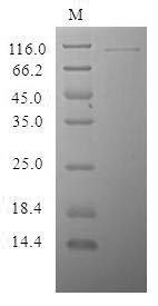(Tris-Glycine gel) Discontinuous SDS-PAGE (reduced) with 5% enrichment gel and 15% separation gel. (Tris-Glycine gel) Discontinuous SDS-PAGE (reduced) with 5% enrichment gel and 15% separation gel.