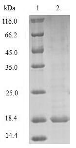 (Tris-Glycine gel) Discontinuous SDS-PAGE (reduced) with 5% enrichment gel and 15% separation gel. (Tris-Glycine gel) Discontinuous SDS-PAGE (reduced) with 5% enrichment gel and 15% separation gel.