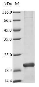 (Tris-Glycine gel) Discontinuous SDS-PAGE (reduced) with 5% enrichment gel and 15% separation gel. (Tris-Glycine gel) Discontinuous SDS-PAGE (reduced) with 5% enrichment gel and 15% separation gel.