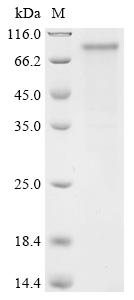 Recombinant Human PR domain zinc finger protein 8 (PRDM8) - image 1