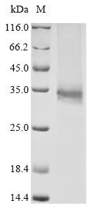 (Tris-Glycine gel) Discontinuous SDS-PAGE (reduced) with 5% enrichment gel and 15% separation gel. (Tris-Glycine gel) Discontinuous SDS-PAGE (reduced) with 5% enrichment gel and 15% separation gel.