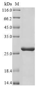 (Tris-Glycine gel) Discontinuous SDS-PAGE (reduced) with 5% enrichment gel and 15% separation gel. (Tris-Glycine gel) Discontinuous SDS-PAGE (reduced) with 5% enrichment gel and 15% separation gel.