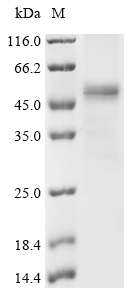 (Tris-Glycine gel) Discontinuous SDS-PAGE (reduced) with 5% enrichment gel and 15% separation gel. (Tris-Glycine gel) Discontinuous SDS-PAGE (reduced) with 5% enrichment gel and 15% separation gel.