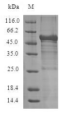 (Tris-Glycine gel) Discontinuous SDS-PAGE (reduced) with 5% enrichment gel and 15% separation gel. (Tris-Glycine gel) Discontinuous SDS-PAGE (reduced) with 5% enrichment gel and 15% separation gel.