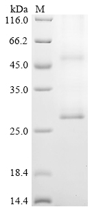 (Tris-Glycine gel) Discontinuous SDS-PAGE (reduced) with 5% enrichment gel and 15% separation gel. (Tris-Glycine gel) Discontinuous SDS-PAGE (reduced) with 5% enrichment gel and 15% separation gel.