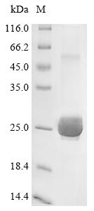Recombinant Human Aquaporin-5 (AQP5) , Nanodisc - image 1