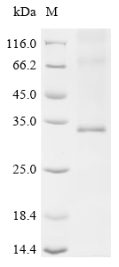 Recombinant Human Aquaporin-7 (AQP7) - image 1