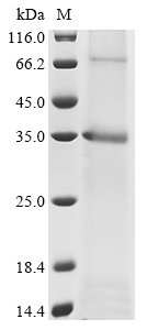 Recombinant Mouse Sodium/potassium-transporting ATPase subunit beta-1 (Atp1b1) - image 1