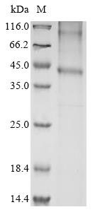 (Tris-Glycine gel) Discontinuous SDS-PAGE (reduced) with 5% enrichment gel and 15% separation gel. (Tris-Glycine gel) Discontinuous SDS-PAGE (reduced) with 5% enrichment gel and 15% separation gel.