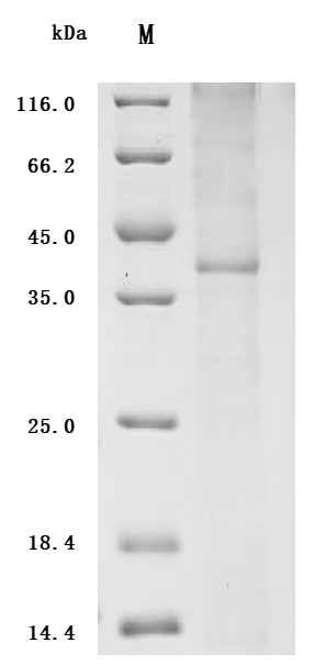 CSB-CF004843HU SDS-page