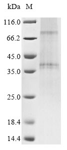 Recombinant Human C-C chemokine receptor type 5 (CCR5) - image 1