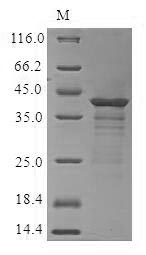 SDS-PAGE- Recombinant protein Human CCR6