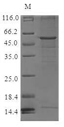 (Tris-Glycine gel) Discontinuous SDS-PAGE (reduced) with 5% enrichment gel and 15% separation gel. (Tris-Glycine gel) Discontinuous SDS-PAGE (reduced) with 5% enrichment gel and 15% separation gel.