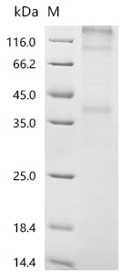 Recombinant Human C-C chemokine receptor type 7 (CCR7) - image 1