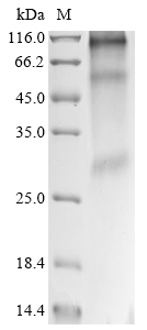 Recombinant Human CD63 antigen (CD63) - image 1