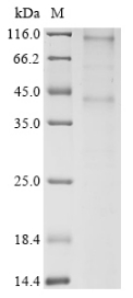 CSB-CF005614HU SDS-PAGE