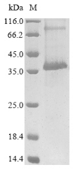 Recombinant Human Cannabinoid receptor 2 (CNR2) - image 1