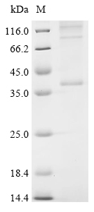 Recombinant Mouse Cannabinoid receptor 2 (Cnr2) - image 1