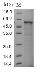 (Tris-Glycine gel) Discontinuous SDS-PAGE (reduced) with 5% enrichment gel and 15% separation gel. (Tris-Glycine gel) Discontinuous SDS-PAGE (reduced) with 5% enrichment gel and 15% separation gel.