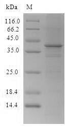 (Tris-Glycine gel) Discontinuous SDS-PAGE (reduced) with 5% enrichment gel and 15% separation gel. (Tris-Glycine gel) Discontinuous SDS-PAGE (reduced) with 5% enrichment gel and 15% separation gel.