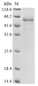 (Tris-Glycine gel) Discontinuous SDS-PAGE (reduced) with 5% enrichment gel and 15% separation gel. (Tris-Glycine gel) Discontinuous SDS-PAGE (reduced) with 5% enrichment gel and 15% separation gel.