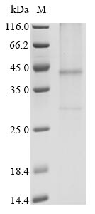 (Tris-Glycine gel) Discontinuous SDS-PAGE (reduced) with 5% enrichment gel and 15% separation gel. (Tris-Glycine gel) Discontinuous SDS-PAGE (reduced) with 5% enrichment gel and 15% separation gel.