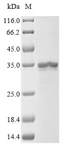 (Tris-Glycine gel) Discontinuous SDS-PAGE (reduced) with 5% enrichment gel and 15% separation gel. (Tris-Glycine gel) Discontinuous SDS-PAGE (reduced) with 5% enrichment gel and 15% separation gel.