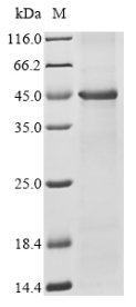 (Tris-Glycine gel) Discontinuous SDS-PAGE (reduced) with 5% enrichment gel and 15% separation gel. (Tris-Glycine gel) Discontinuous SDS-PAGE (reduced) with 5% enrichment gel and 15% separation gel.