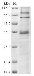 Recombinant Human Proteinase-activated receptor 3 (F2RL2) - image 1